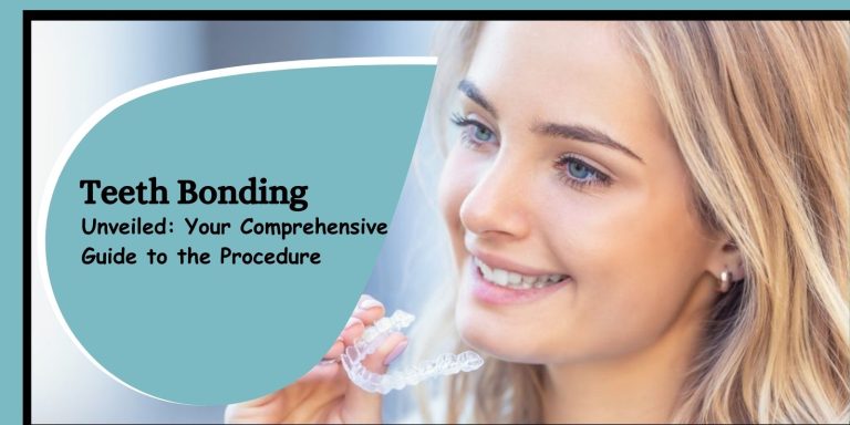 Teeth Bonding Unveiled: Your Comprehensive Guide to the Procedure